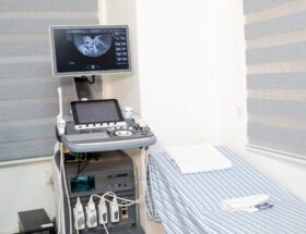 4D Ultrasound