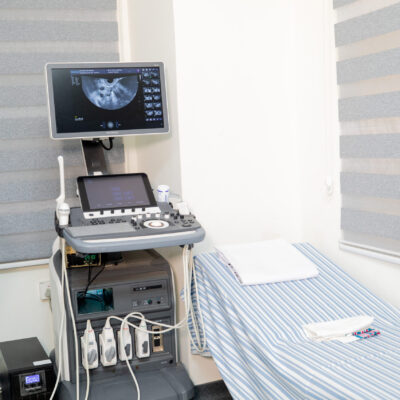 4D Ultrasound